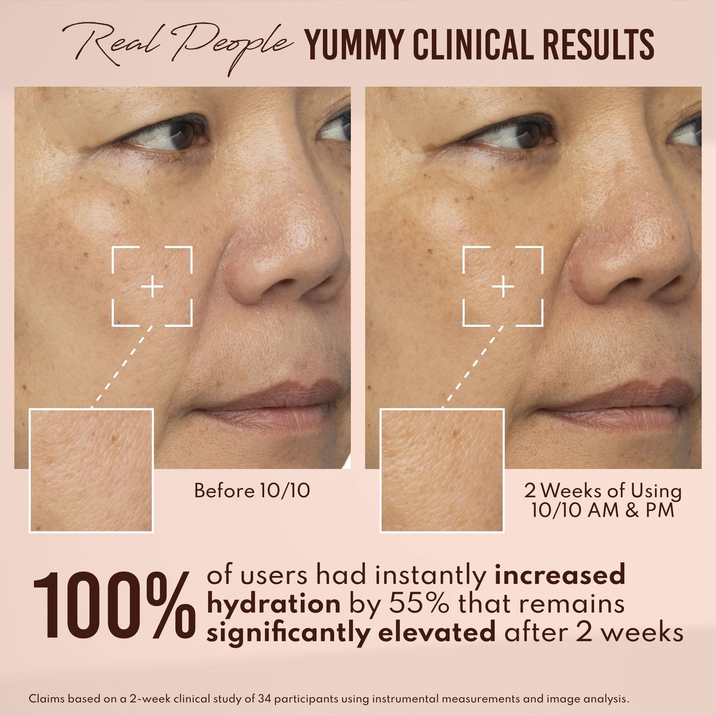 Yummy Skin 10/10 Barrier Boost Hyaluronic Acid + Ectoin Plumping Serum